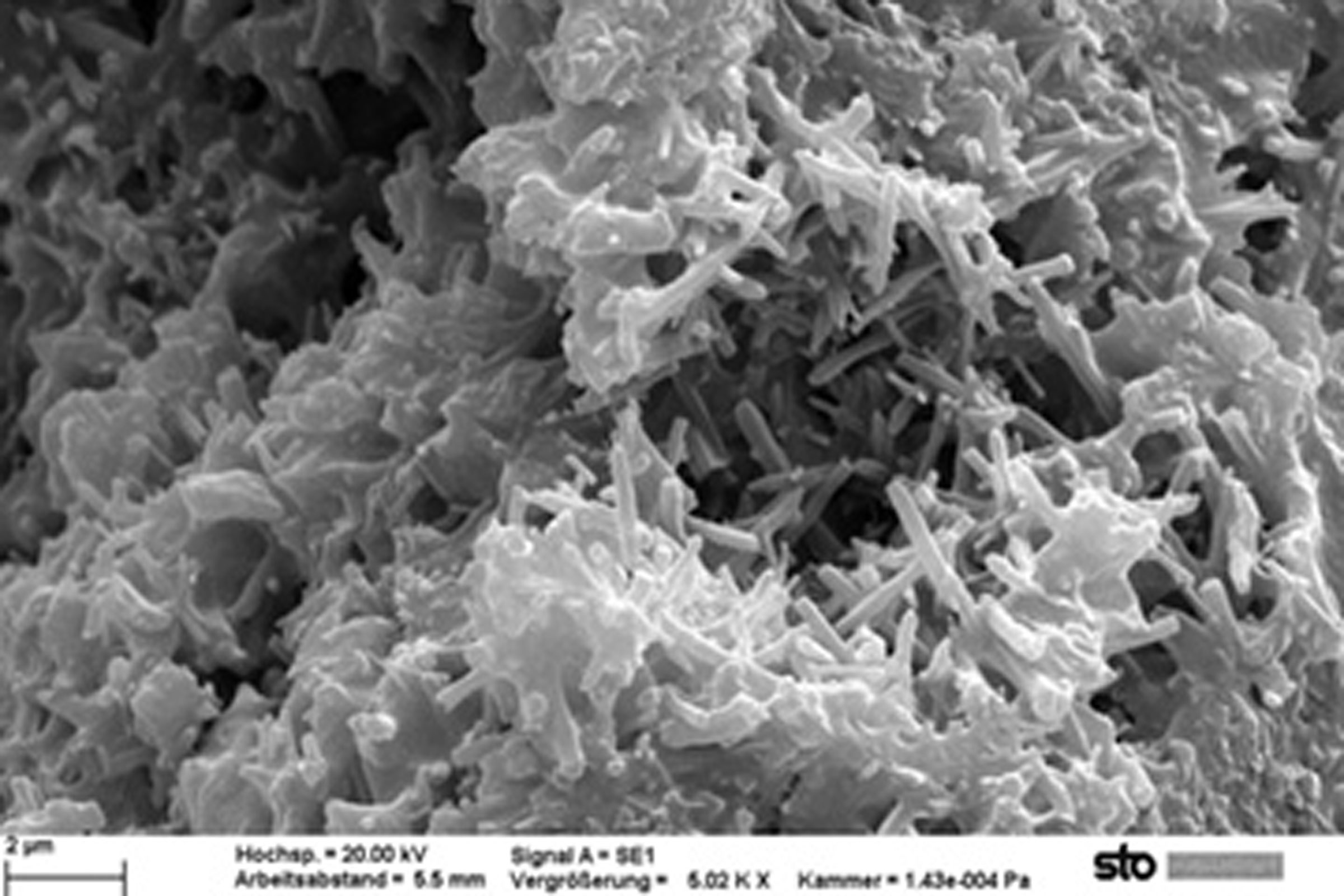 The image taken with a scanning electron microscope shows the microscopic structure.